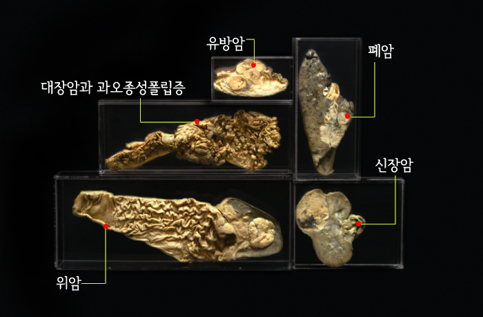 인체병리전시회_사진.jpg