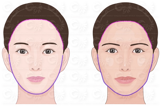 한국인이 선호하는 얼굴(왼쪽)과 파라과이인이 선호하는 얼굴.  3D 입체측정 결과 분석을 통해 한국인과 파라과이인이 선호하는 얼굴을 그림으로 나타냈다. 